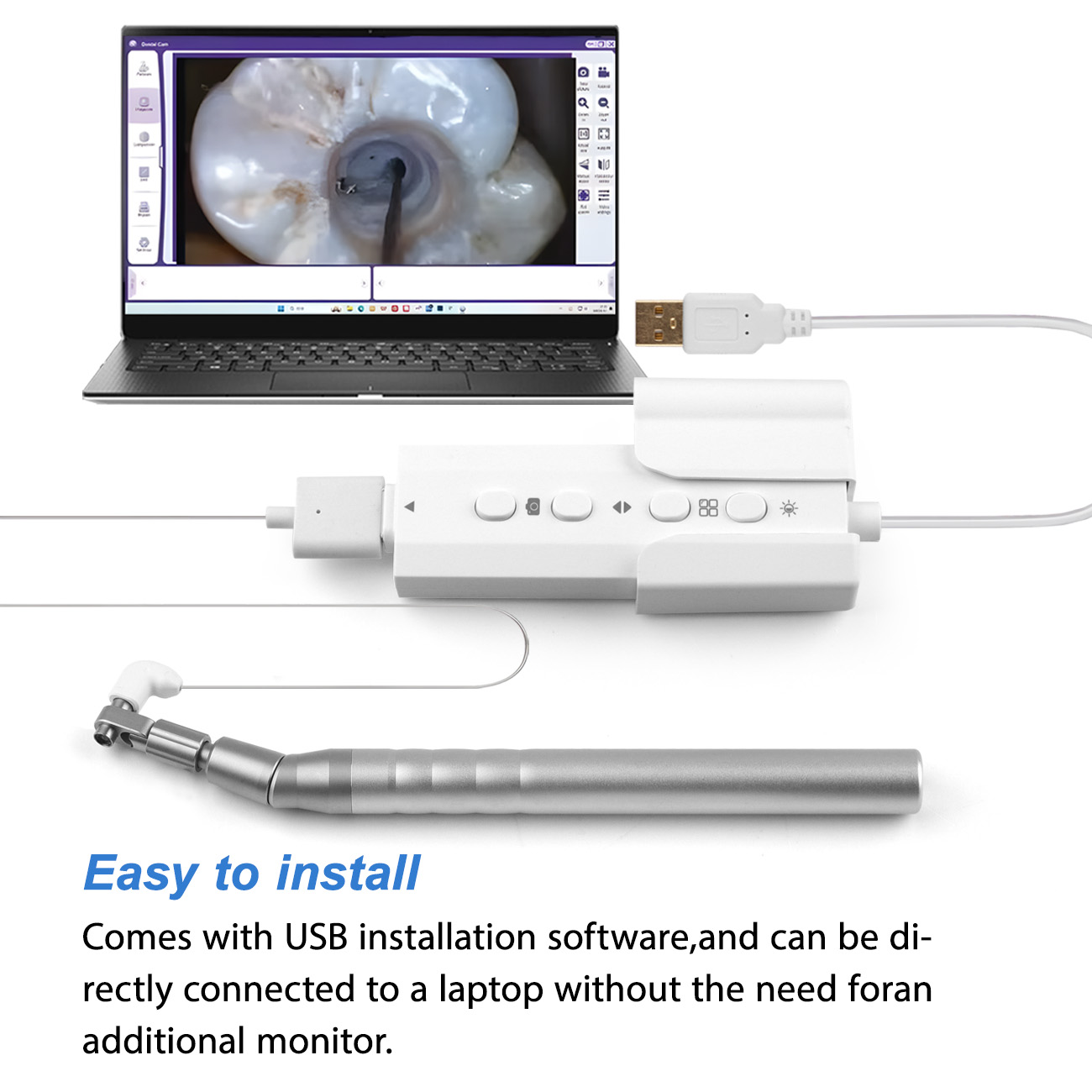 Micro Dental Intraorale Camera - Photography Dental recensie en prijs