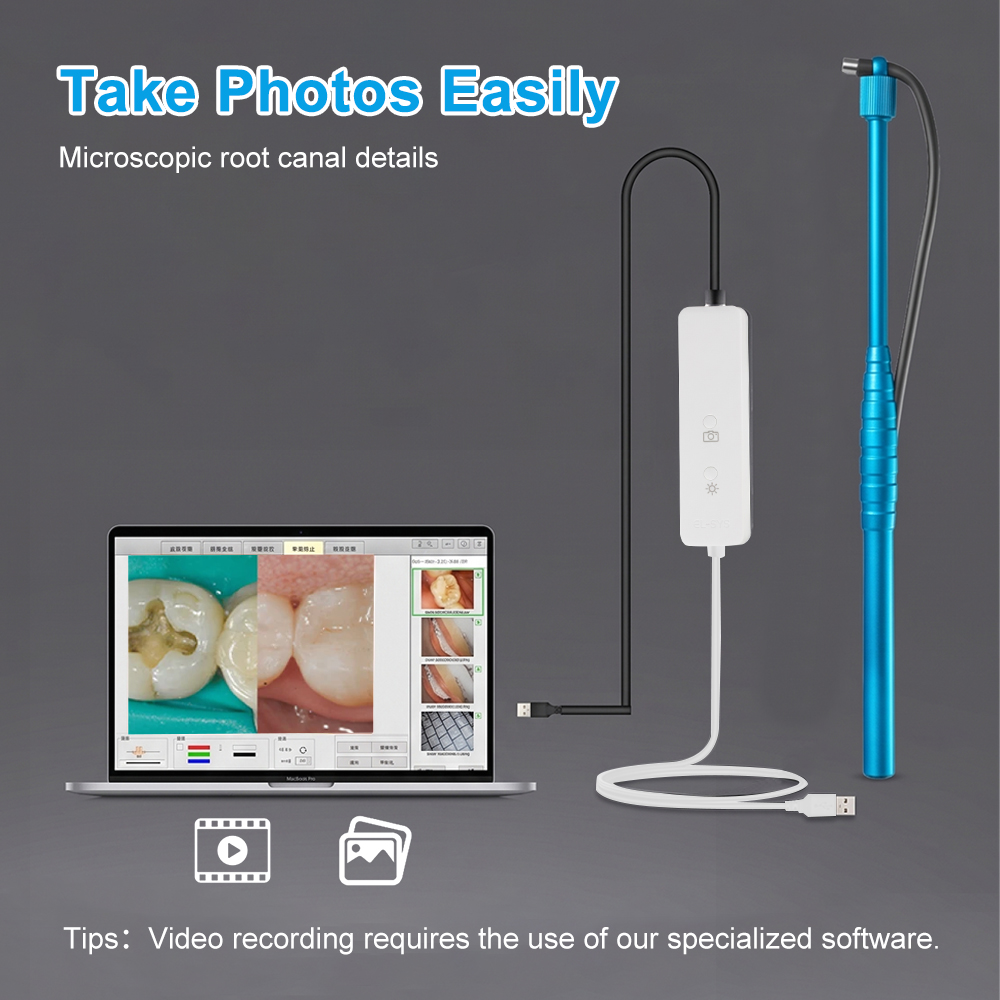 5MP Micro Intraorale Camera, T - Photography Dental recensie en prijs
