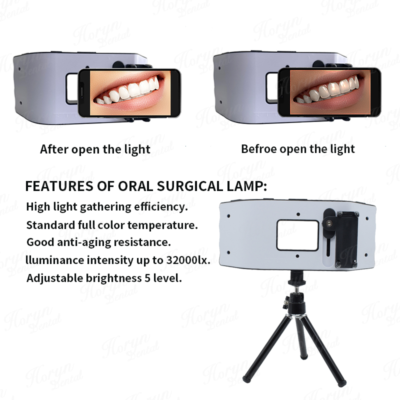 Tandheelkundige flitslicht Fot - Photography Dental recensie en prijs